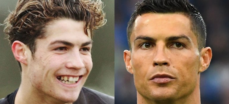 Estas son las 5 cirugías estéticas que se hizo Cristiano Ronaldo