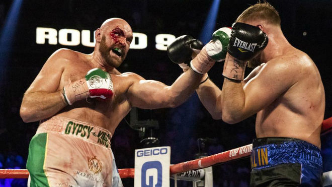 Le costo sudor y sangre a Tyson Fury vencer a Otto Wallin