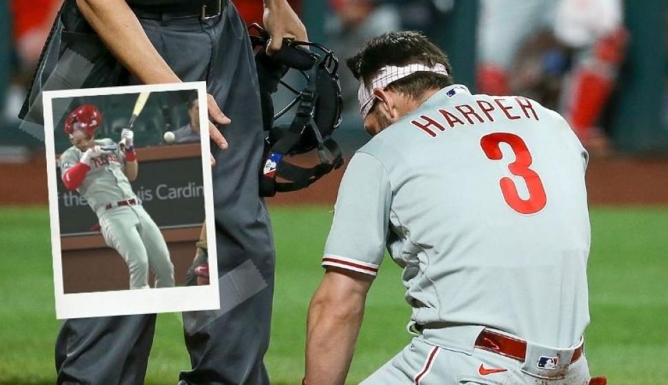 Bryce Harper recibió un pelotazo en la cara a 150 km/h en la MLB