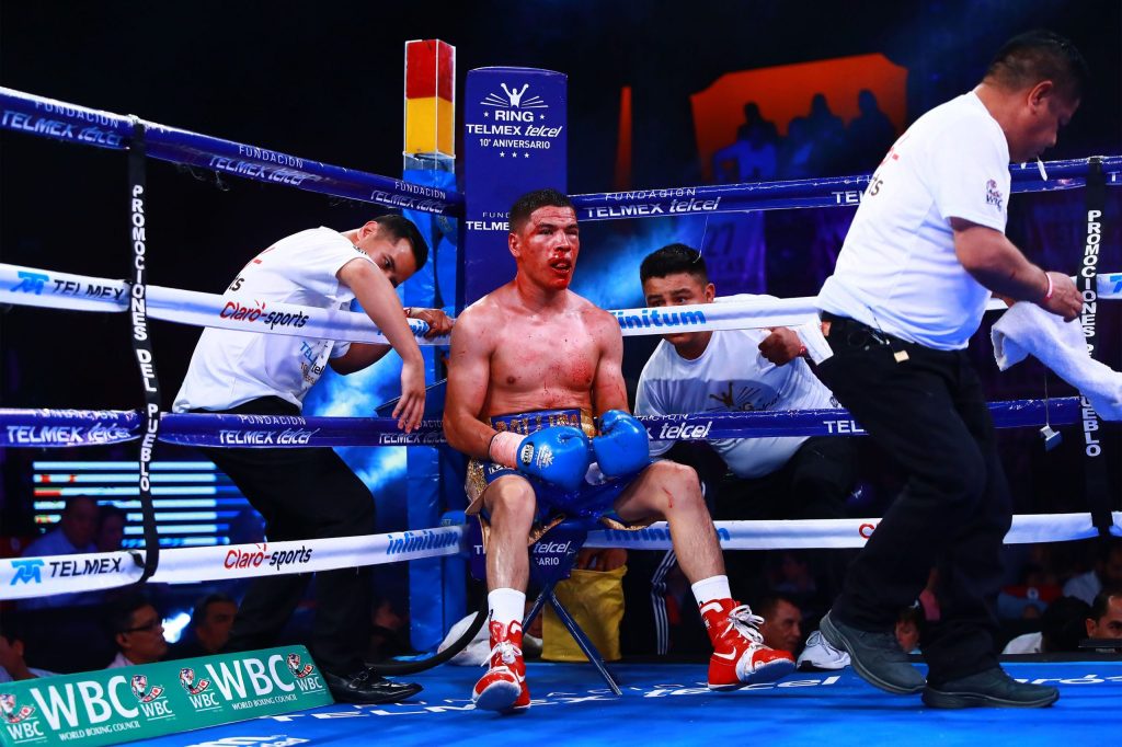 Boxeador mexicano Julio Ceja sufrió el nocaut y terminó en el hospital