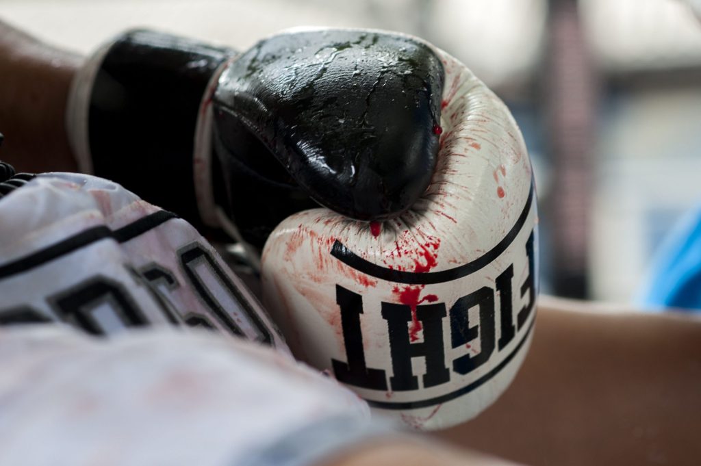 Detienen a boxeador canadiense en México por tentativa de feminicidio tras dar golpiza a dos mujeres