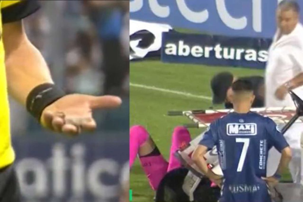 Suspenden partido del ascenso argentino tras agresión a arquero con pedrada